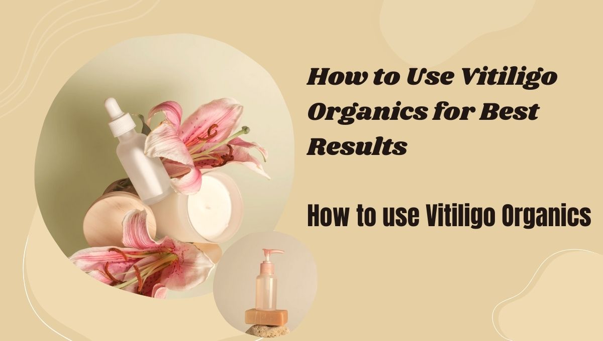 How to Use Vitiligo Organics for Best Results