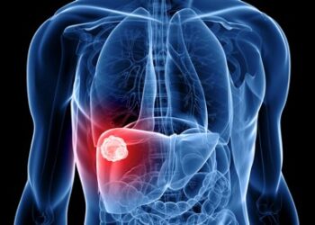 Common Signs and Symptoms of Liver Cancer